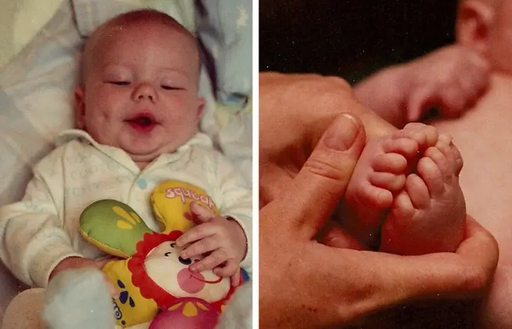 I-was-born-with-12-fingers-and-toes.-All-fully-functional.-Here-are-my-baby-pictures